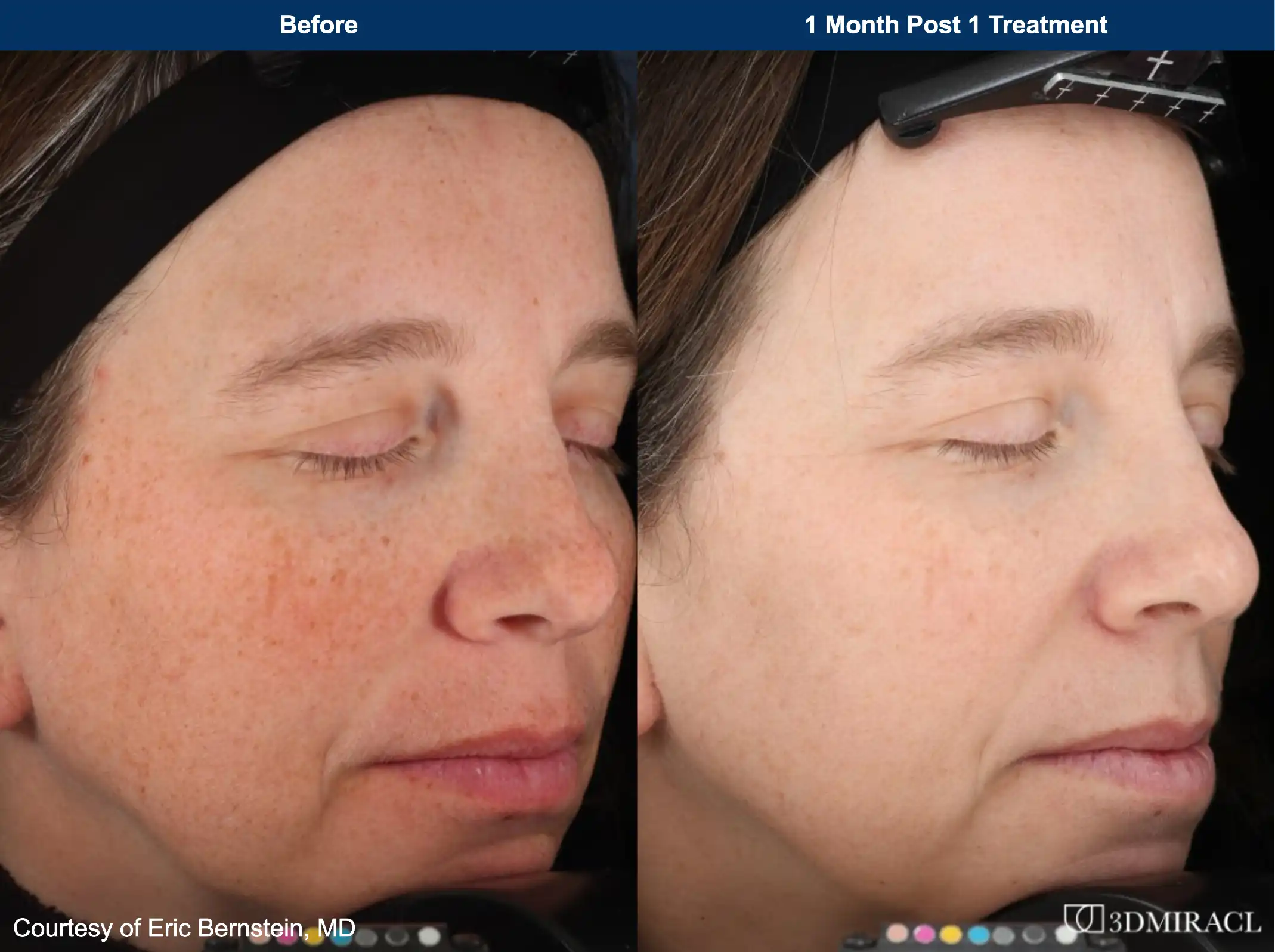 B&A 1 B&A 1