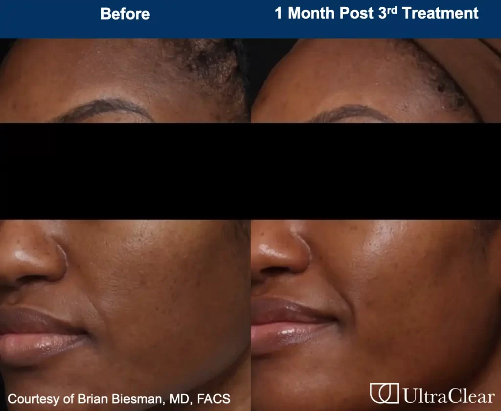 B&A 2 B&A 2