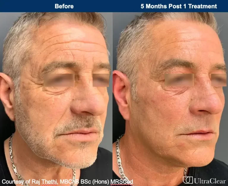 B&A 3 B&A 3