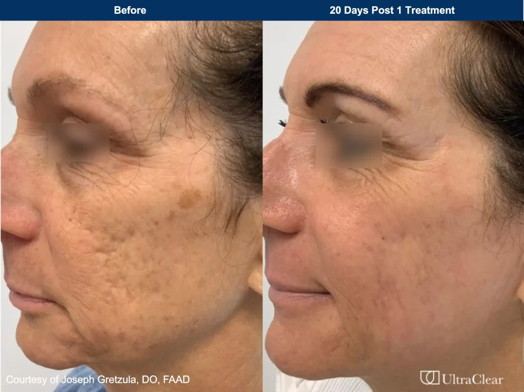 B&A 4 B&A 4